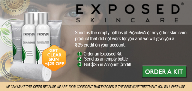 ExposedSkin Care